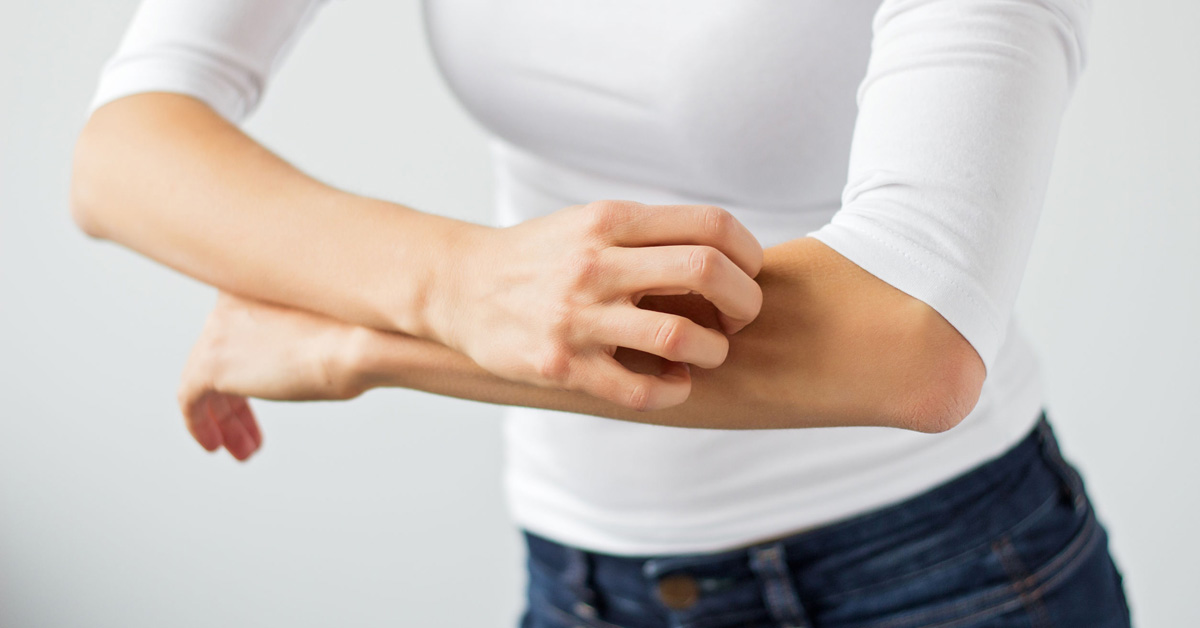 Ayurvedic Treatments, Diet, Home Remedies for Psoriasis.