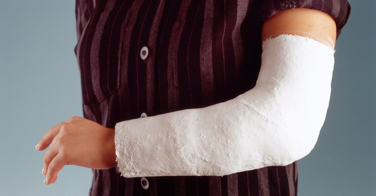 Foods to heal broken bones