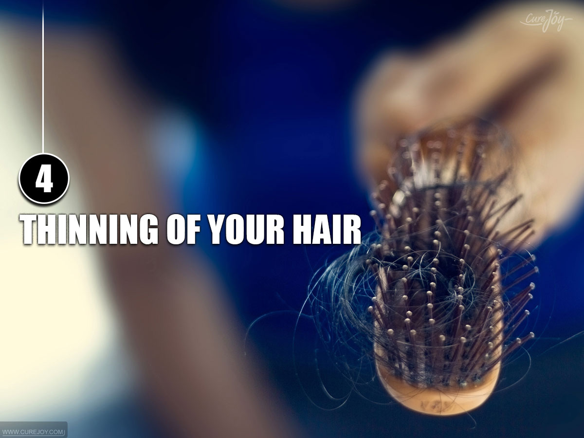4-Thinning-of-Your-Hair