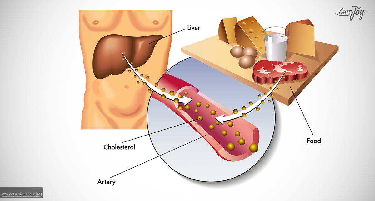 For_A_Healthy_Heart_Just_Lowering_LDL_Cholesterol_Is_Not_Enough