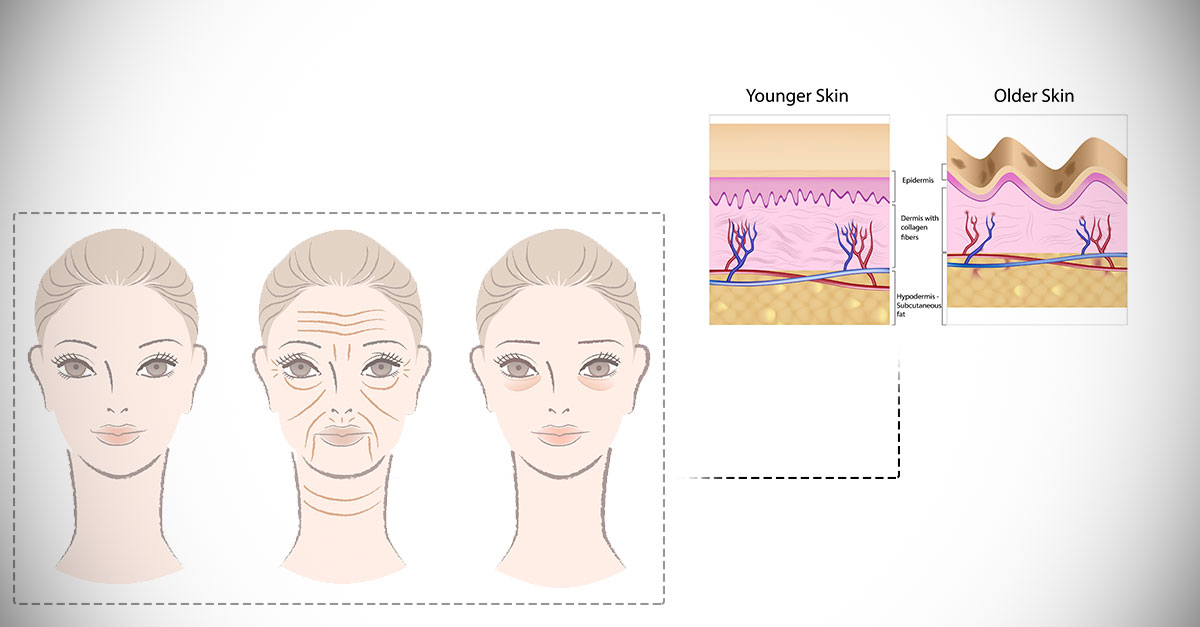 Which_Foods_Should_I_Avoid_To_Prevent_Skin_Aging