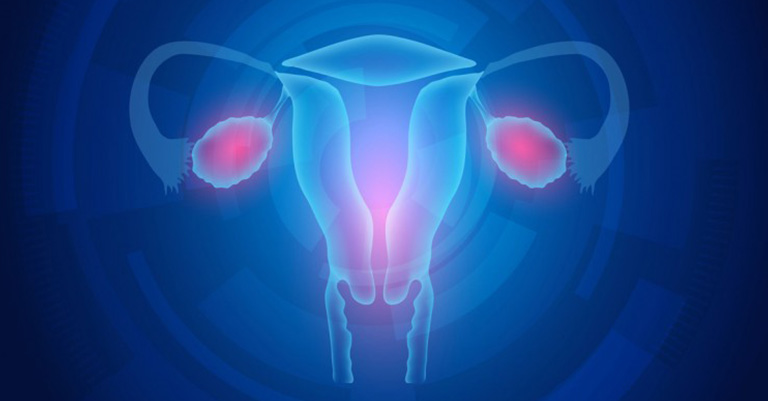 8-Early-Signs-Of-Ovarian-Cancer