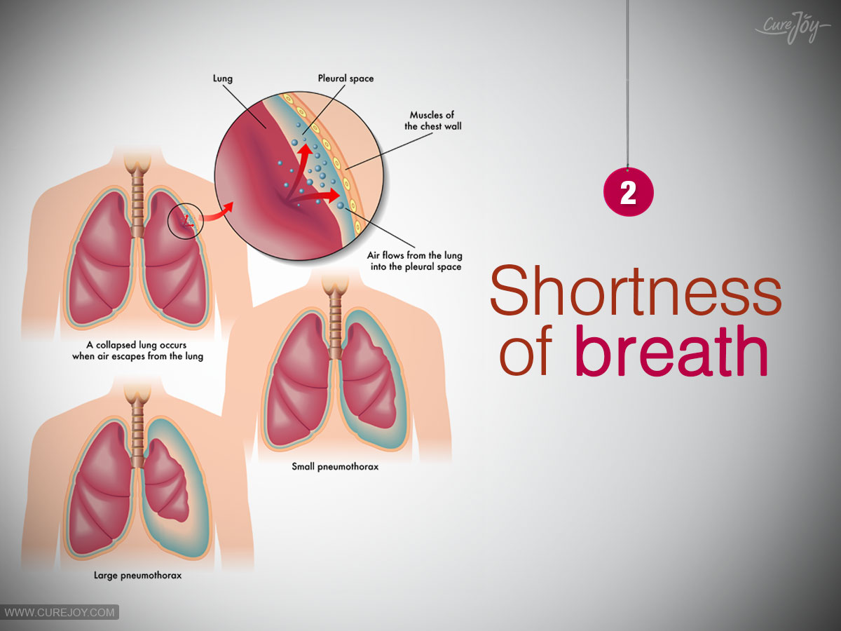 2-Shortness-of-breath