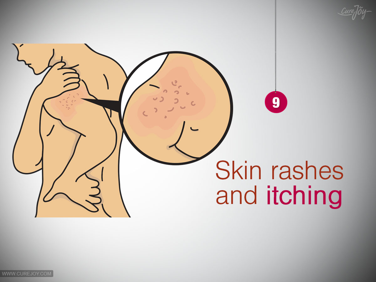 9-Skin-rashes-and-itching