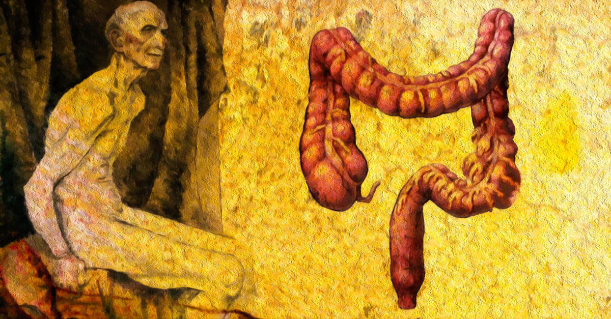 Prevent colorectal cancer naturally