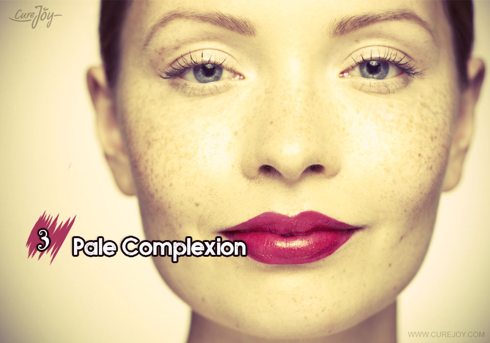 3-pale-complexion