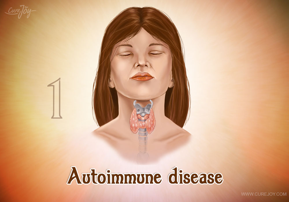 1-autoimmune-disease