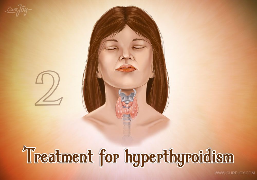2-treatment-for-hyperthyroidism
