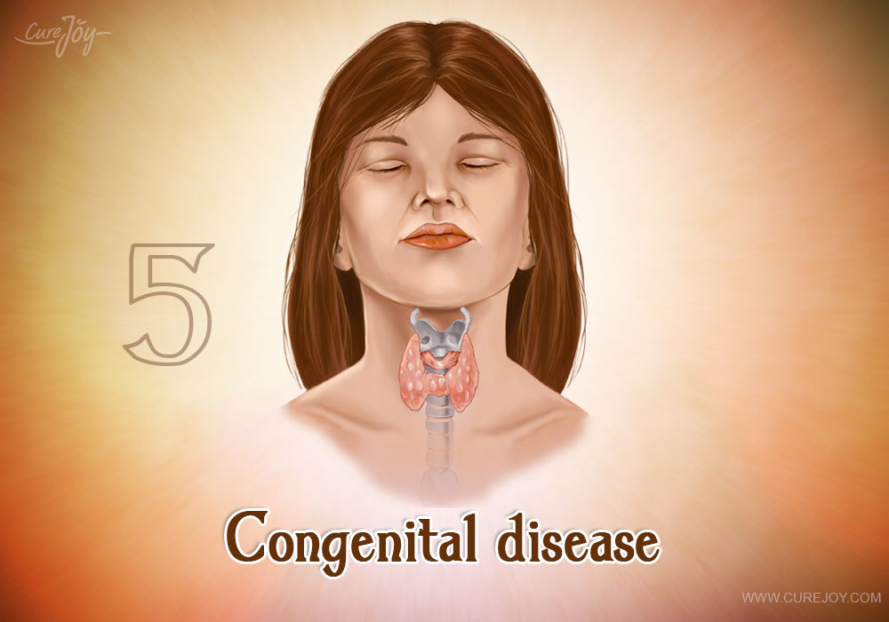 5-congenital-disease