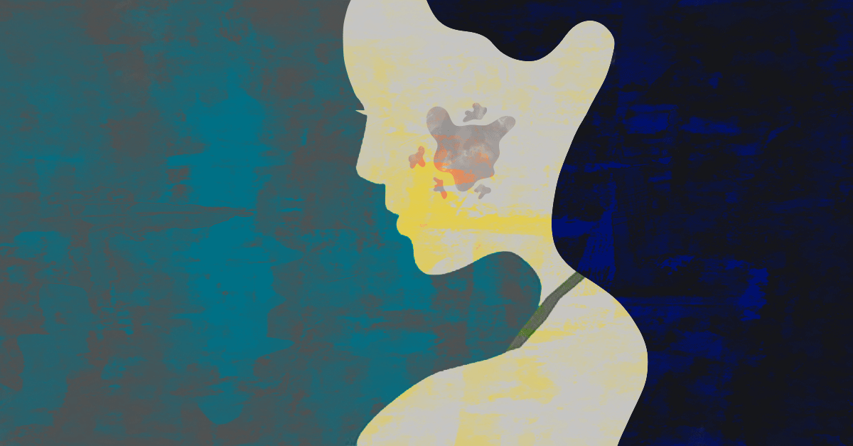 Home remedies for melasma