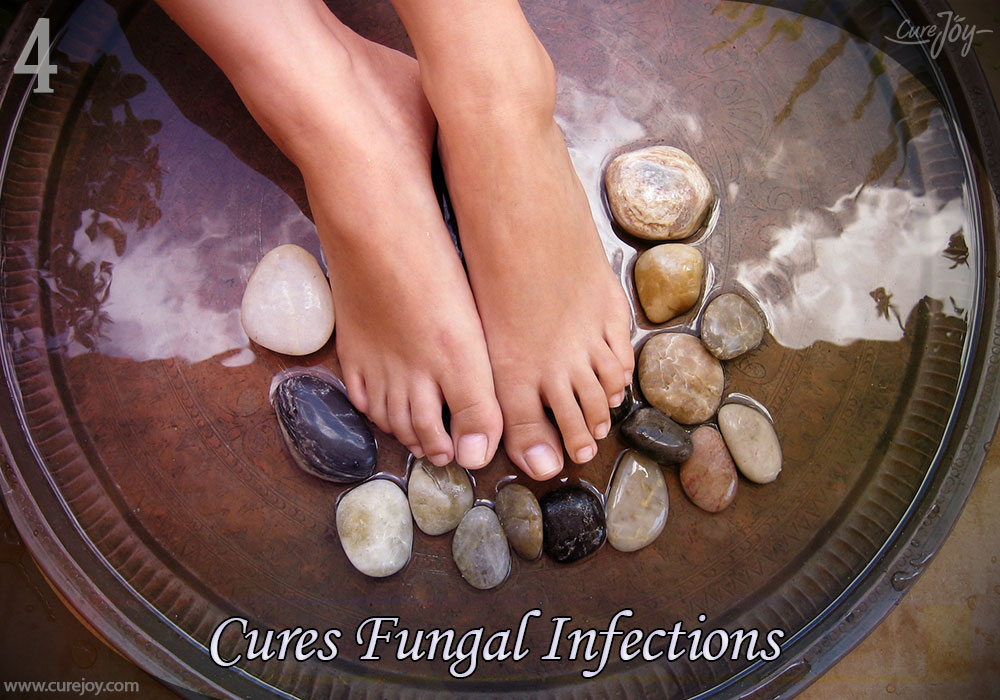 4-cures-fungal-infections