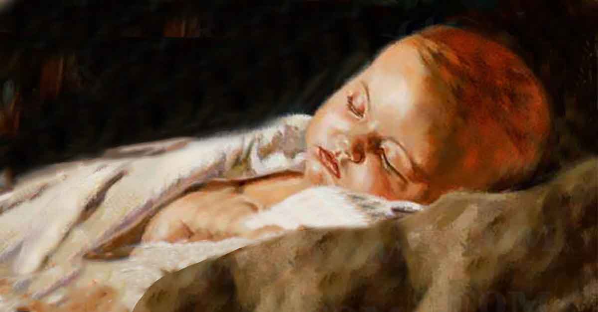 natural treatments for cradle cap