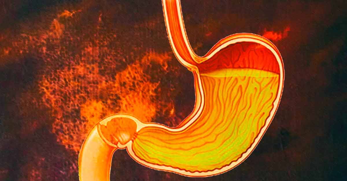 home remedies for indigestion