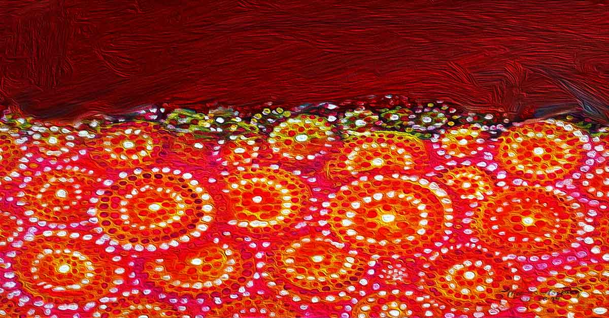 causes of high hemoglobin levels