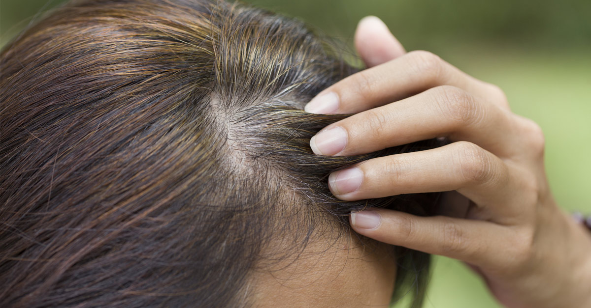 6 Causes Of Premature Graying Of The Hair