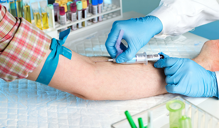 Blood tests are often used to diagnose priapism