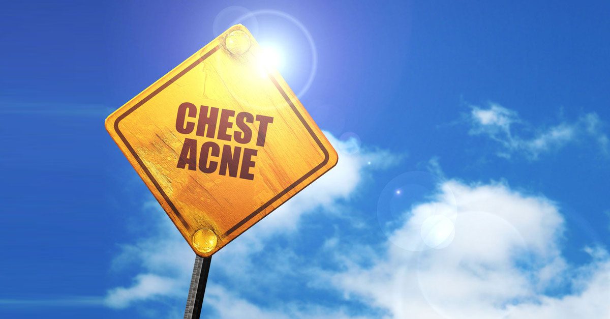 12 Home Remedies To Get Rid Of Chest Acne