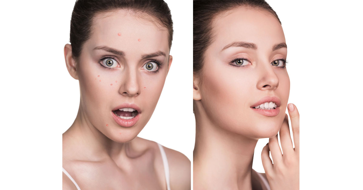 Skin problems are quite common in adults