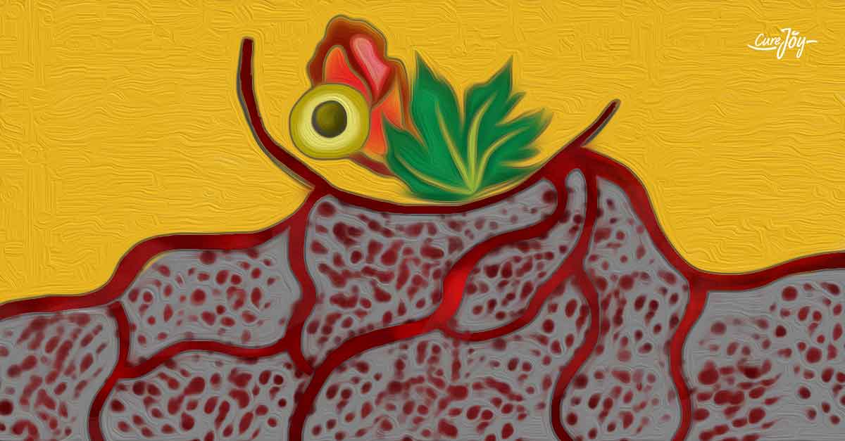 how to increase platelet count naturally