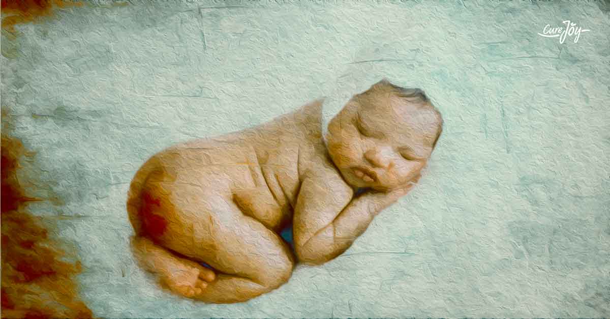 tips to treat your baby's diaper rash