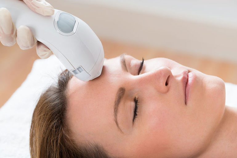 Laser uses heat to damage the hair follicles