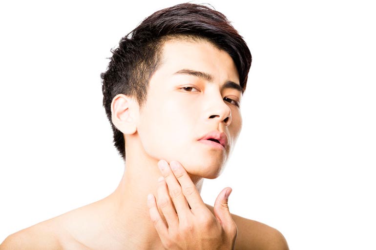Moisturisers can prevent acne