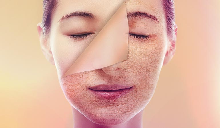 Your Dry Skin May Be A Result Of Several External Or Internal Conditions