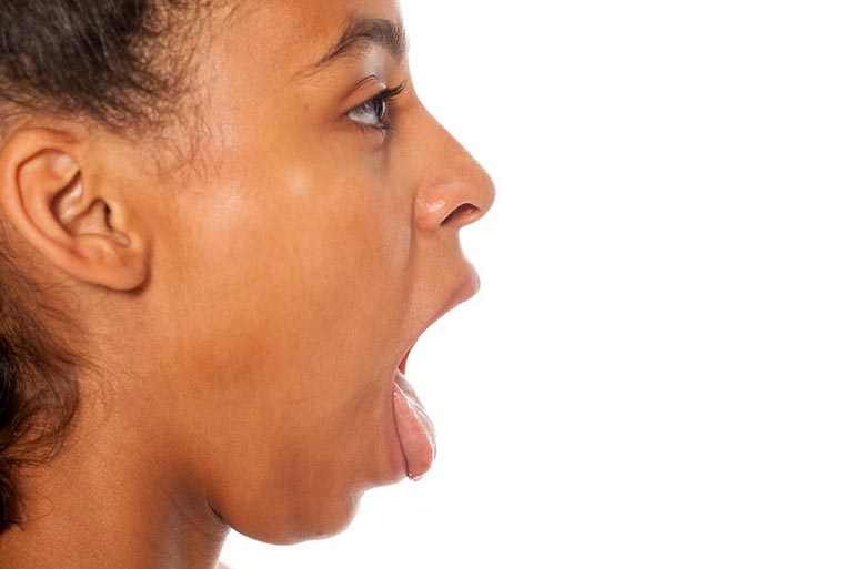 Excess melanin production can cause dark spots on the tongue