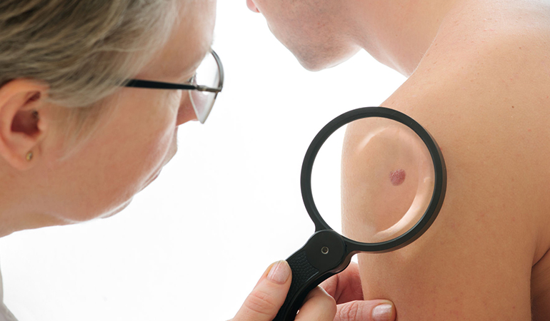 Lowers Risk Of Skin Cancer