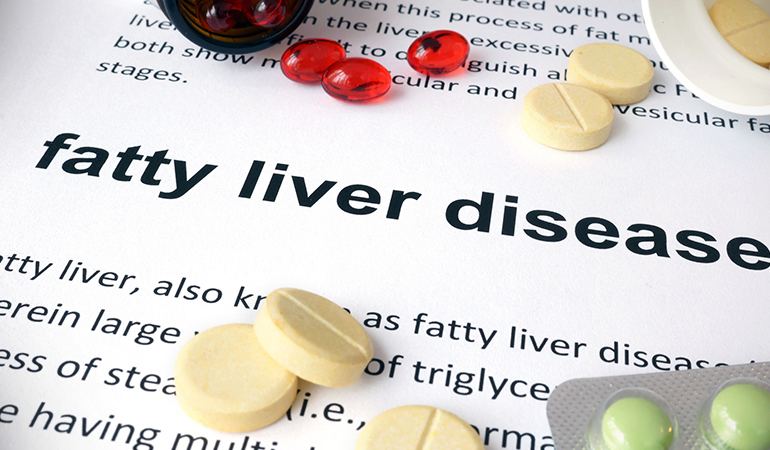 Type 2 diabetes, obesity, and metabolic syndrome causes fatty liver disease