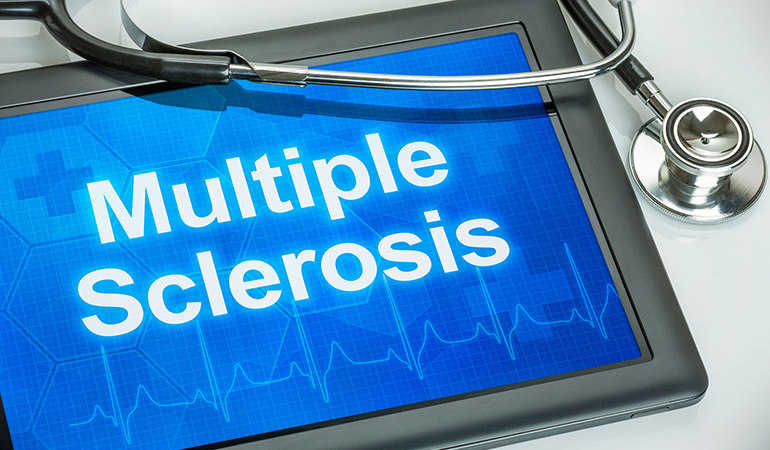 Multiple sclerosis is inflammation of the central nervous system