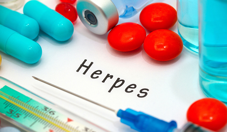 sores on genitals in herpes