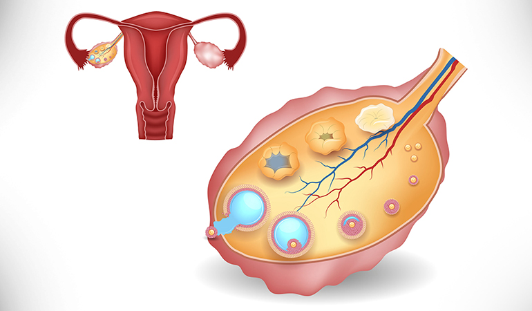 Cervix or pelvis disorders trigger spotting.