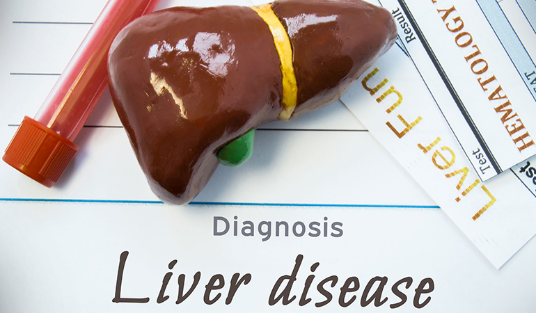 Routine blood tests may help diagnose a fatty liver disease